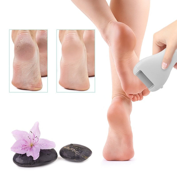 Electric Callus Remover