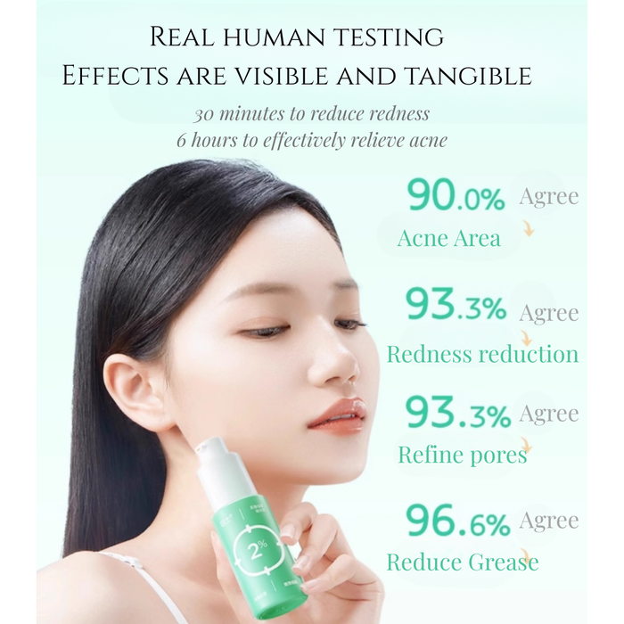 Yin Shi Gentle Acne Treatment Serum 15ml - myernk